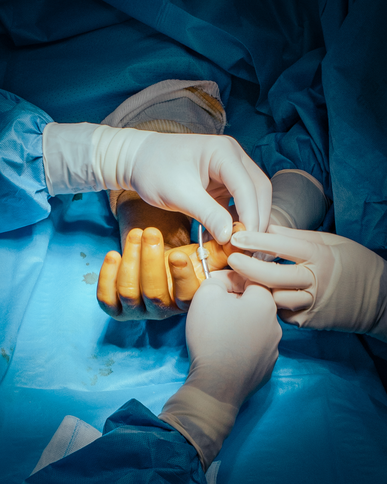 3 months in an orthopedic surgery room